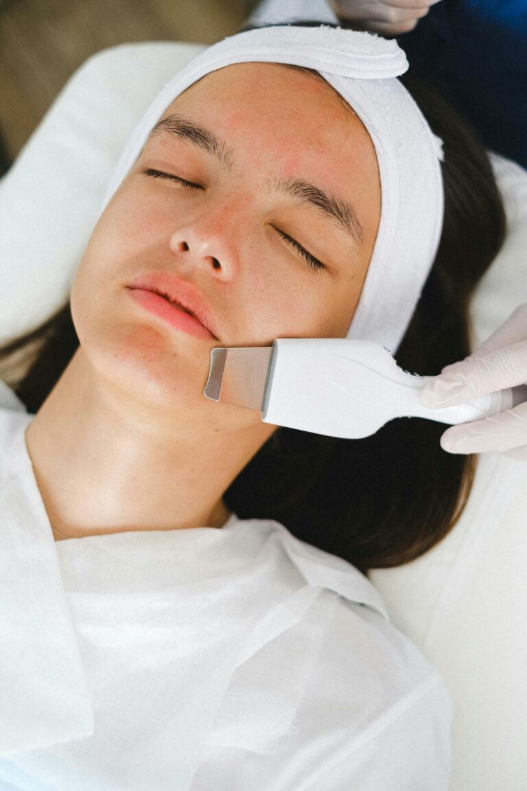 microneedling
